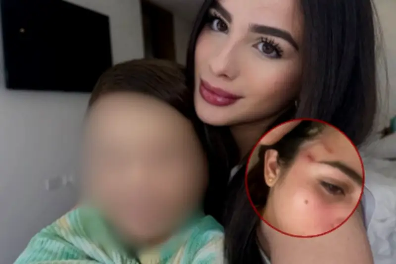 Fiorella Capella clama justicia tras agresión viral de su expareja en Cartagena