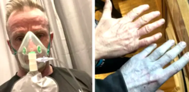 Hombre despertó con piel azul y alarmó a hospital: la causa fue una decepción cotidiana