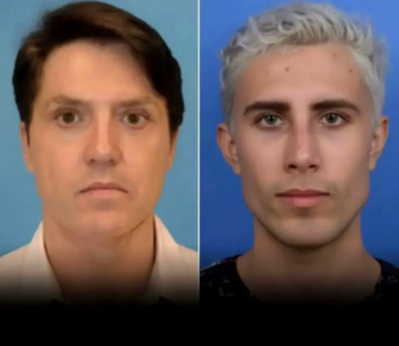 Hombre se somete a 37 cirugías plásticas para evadir orden de alejamiento y acechar a su expareja