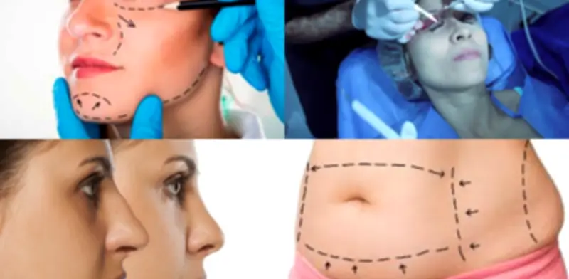 Infecciones son la principal complicación en cirugía plástica en Colombia según encuesta nacional