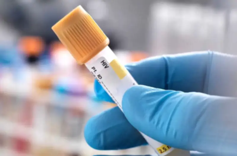 ITS asintomáticas en Bucaramanga: pruebas clave para diagnóstico oportuno