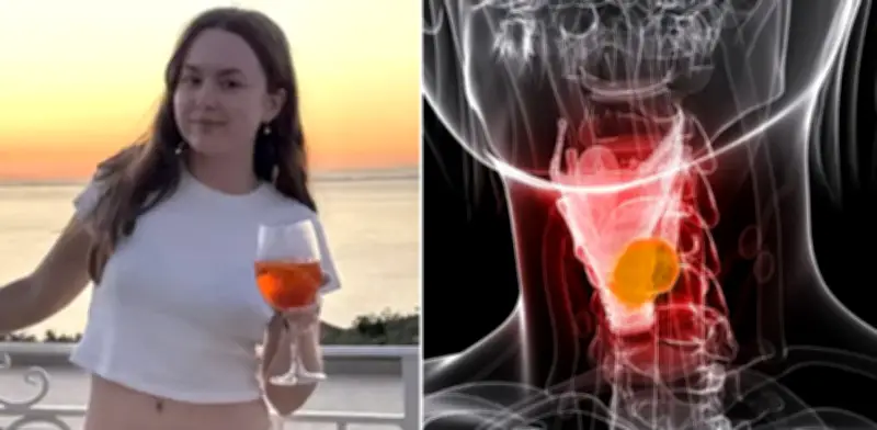 Joven de 22 años creyó tener intolerancia al alcohol, pero era cáncer de linfoma de Hodgkin