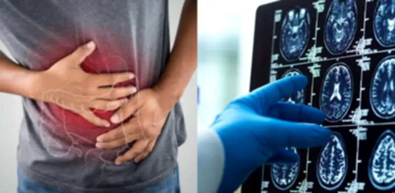 La pérdida de memoria se origina en el intestino: hallazgo científico revolucionario