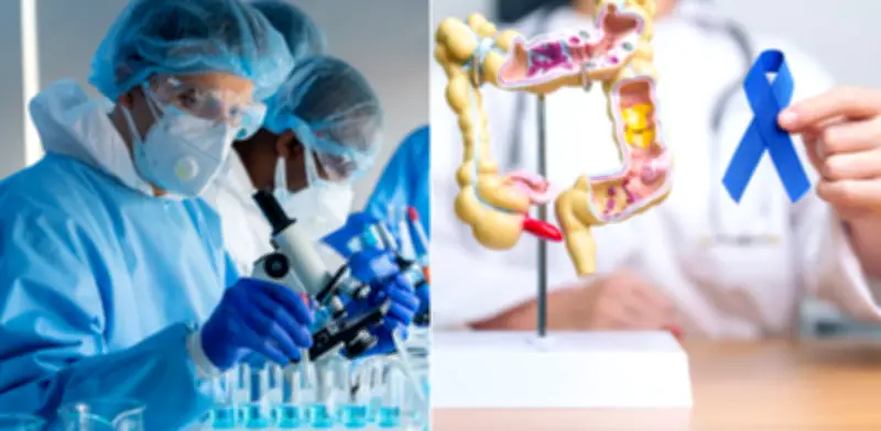 Modelo argentino de prevención del cáncer de colon sirve como guía para Colombia