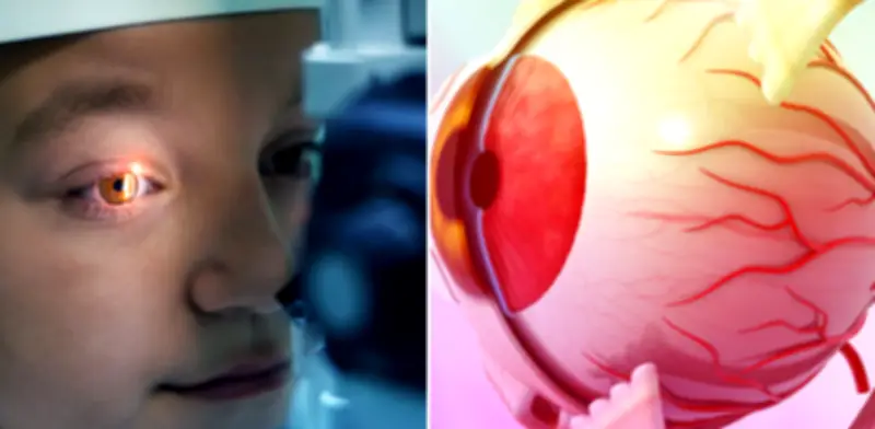 Moscas volantes en la visión: cuándo son señal de alerta para problemas en la retina