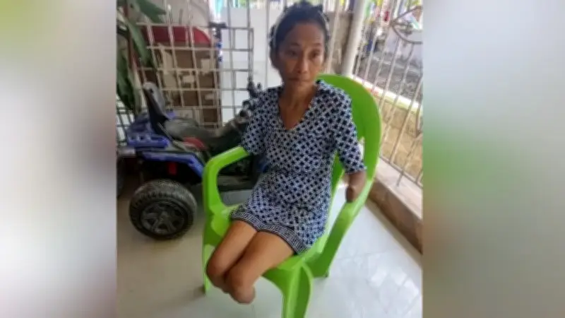 Mujer pierde extremidades tras complicación médica en Barranquilla por cuadro febril