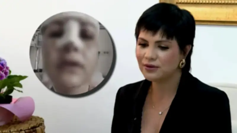 Mujer sobreviviente de ataque con martillo muestra su rostro tras recuperación