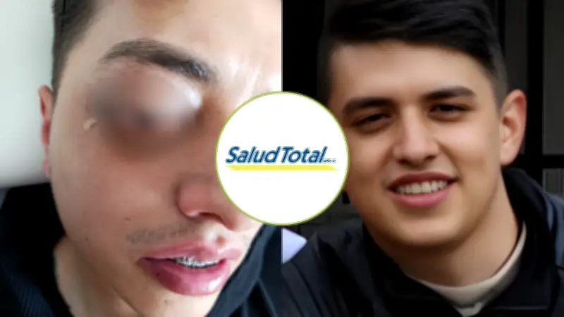 Negligencia médica en EPS Salud Total: Joven de 24 años al borde de perder su ojo por falta de atención