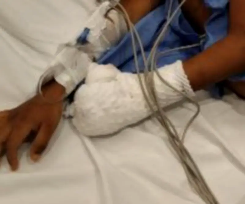 Niño de 5 años torturado en Cartagena: denuncia anónima reveló abusos por abuela de crianza