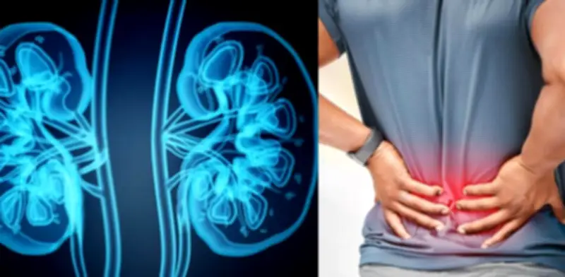 Ocho señales de alerta renal: dolor lumbar y otros síntomas que no debe ignorar