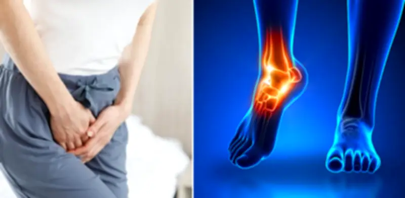 Puerto Rico marca hito médico con implante de dispositivo en tobillo para tratar incontinencia urinaria