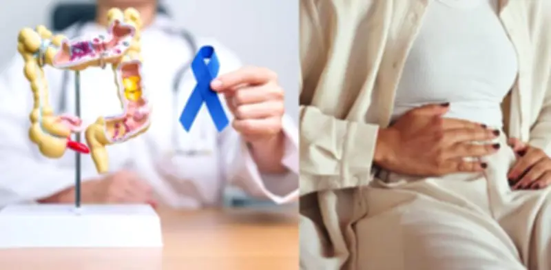 Seis señales iniciales del cáncer de intestino que no debe pasar por alto