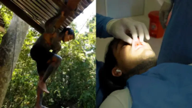 Yeferson Cossio sufre accidente en el Amazonas y requiere intervención médica urgente