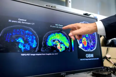 Análisis de sangre podría predecir riesgo de demencia décadas antes de los síntomas