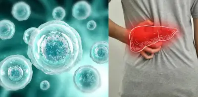 Células zombis de la Clínica Mayo desencadenan inflamación en hígado graso