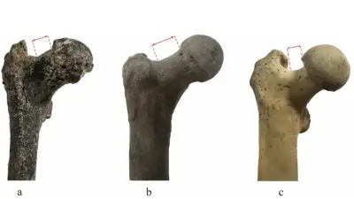 Fósil de 7 millones de años en Europa desafía teoría de que el humano empezó a caminar en África
