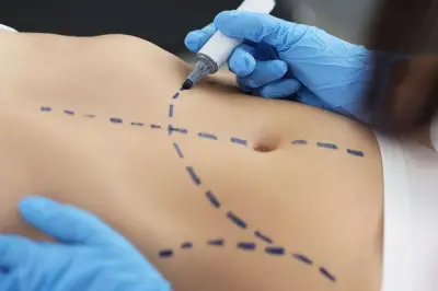 Justicia colombiana ratifica que cirugías plásticas son obligación de medios, no de resultados