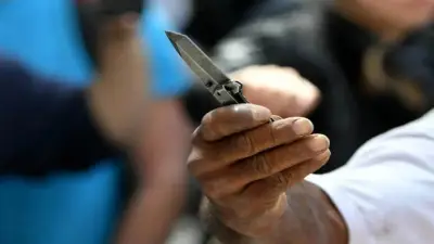 Menor herido de gravedad en Soacha tras ataque con arma de fuego incrustada en su rostro