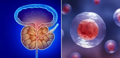 Prueba que 'ilumina' células del cáncer de próstata podría reducir biopsias a la mitad, según estudio internacional