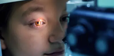 Terapias intravítreas: inyecciones oculares que transforman el tratamiento de enfermedades de la retina en Colombia