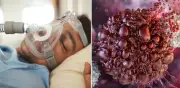 Apnea obstructiva del sueño aumenta riesgo de cáncer y mortalidad según jefe de neumología