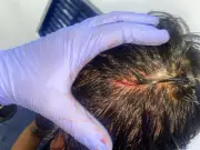 Escándalo en la Liga Betplay: Diego Novoa de Millonarios acusado de agresión brutal contra jugador de Boyacá Chicó