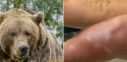 Hombre contrae rara infección 'dedo de foca' tras contacto con oso pardo en Alaska