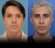 Hombre se somete a 37 cirugías plásticas para evadir orden de alejamiento y acechar a su expareja