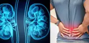 Ocho señales de alerta renal: dolor lumbar y otros síntomas que no debe ignorar