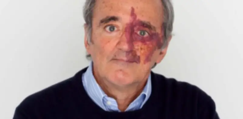 Academia de EE.UU. retira artículo sobre cáncer de páncreas por conflicto de intereses