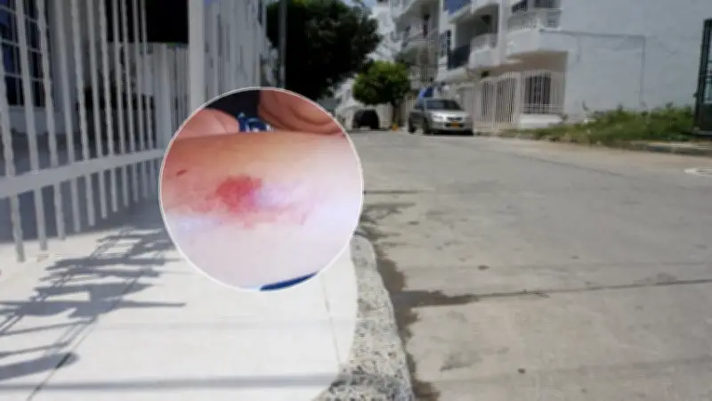 Cartagena: Violento intento de robo en El Country reactiva alarmas de seguridad