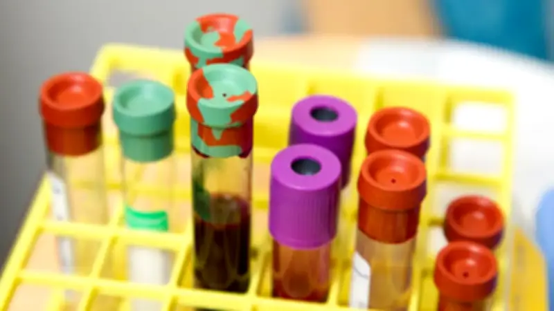 Científicos avanzan en método para detectar cáncer con un simple análisis de sangre