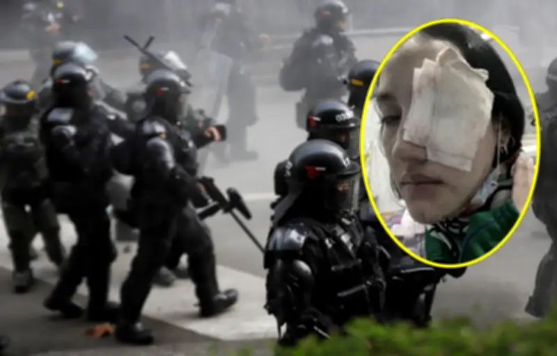 Condenan a 7 años a expolicía del Esmad por dejar ciega a estudiante durante protestas de 2021