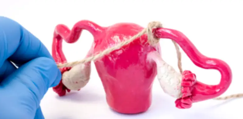 Corte Constitucional ordena a EPS cubrir reversión de ligadura de trompas tras pérdida de hijo