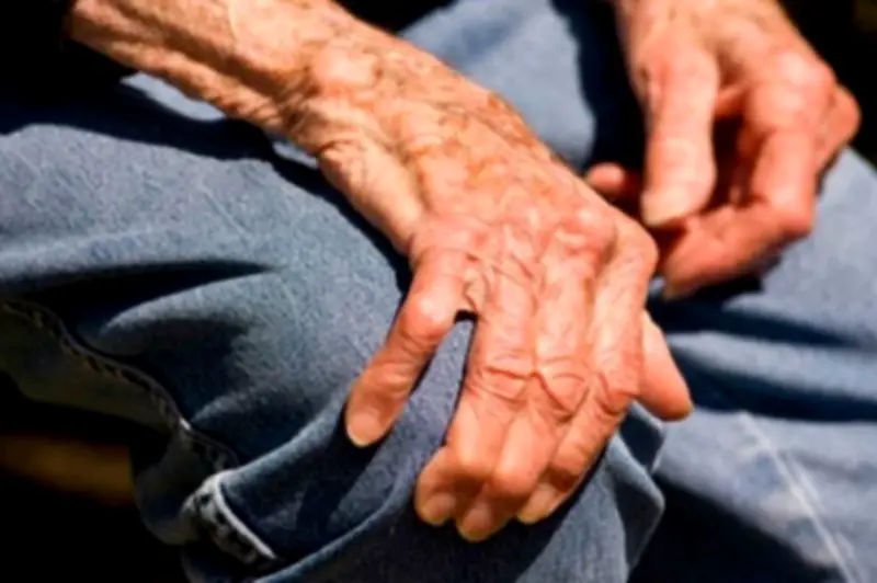 Dispositivo chileno 'Grace' elimina temblores de Parkinson sin cirugía ni fármacos