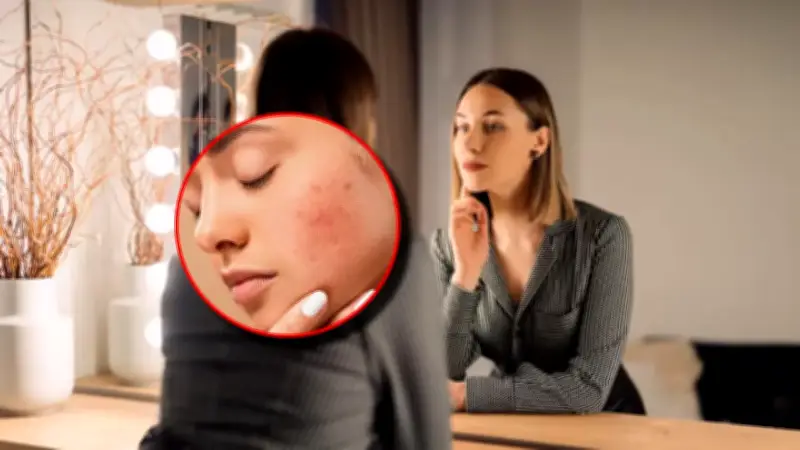 El estrés no solo afecta la mente: estudio revela cómo se refleja en la piel