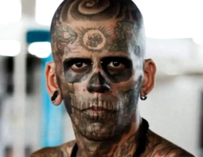 El hombre más tatuado de Brasil revela su transformación tras tratamiento láser