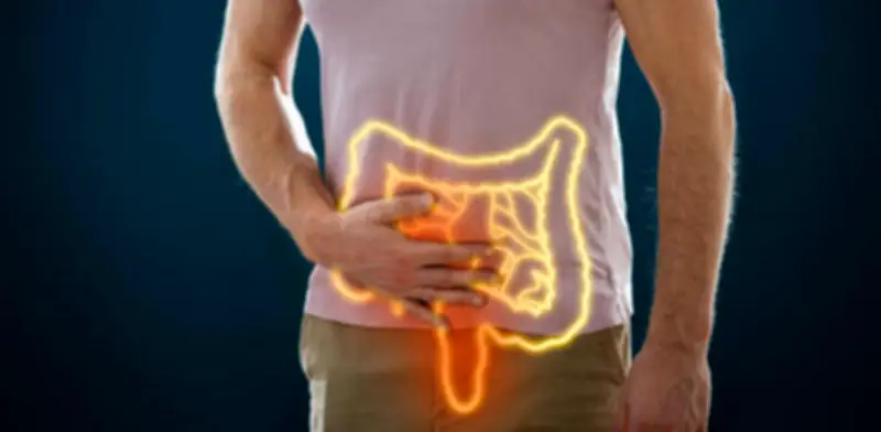 Estudio revela que aumento de muertes por cáncer colorrectal en jóvenes afecta principalmente a personas con menor educación