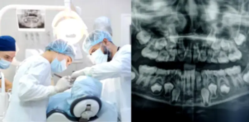 Hombre británico pierde todos sus dientes tras cirugía dental fallida en Turquía