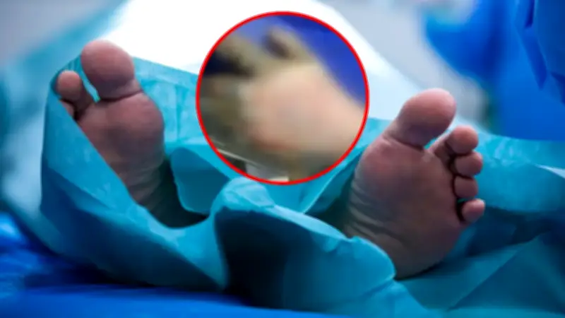 Hombre declarado muerto despierta en la morgue: insólito caso médico en Colombia