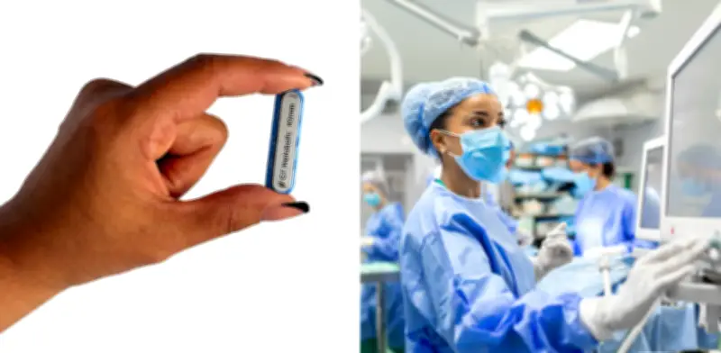 Imanes comestibles reemplazan cirugías bariátricas para adelgazar: ¿son seguros?