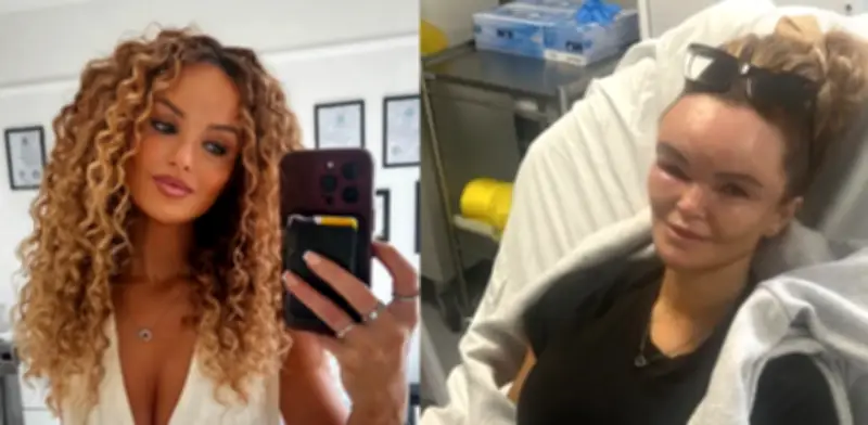 Profesora británica revela cómo el estrés tras accidente desató enfermedad que deforma su rostro