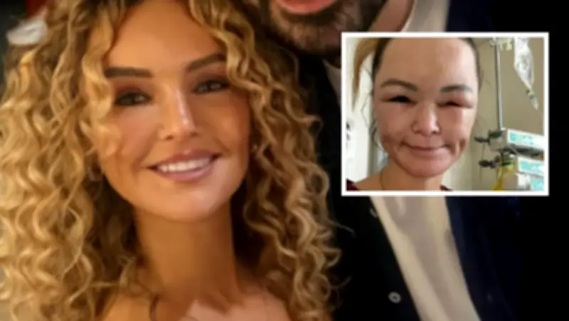 Profesora británica revela cómo enfermedad rara deformó su rostro tras accidente vial