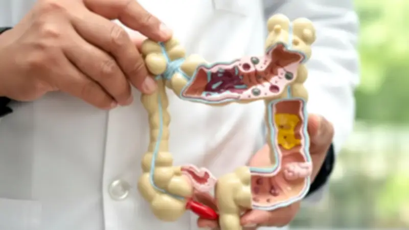 Señales tempranas del cáncer de colon que no debe ignorar bajo ningún motivo