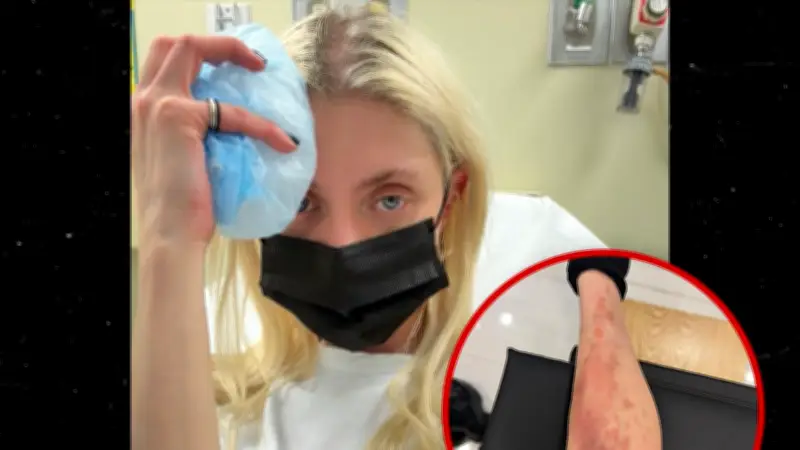 Taylor Momsen hospitalizada por picadura de araña venenosa en México