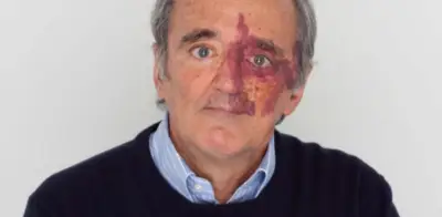 Academia de EE.UU. retira artículo sobre cáncer de páncreas por conflicto de intereses