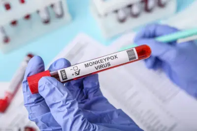 Colombia detecta primer caso de viruela símica Clado Ib, más grave, en Antioquia