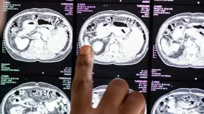 Futbolista argentino sufre ACV antes de partido: club detalla su estado de salud