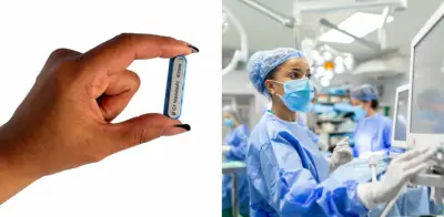 Imanes comestibles reemplazan cirugías bariátricas para adelgazar: ¿son seguros?