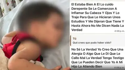 Niño de 2 años con cabeza inflamada y quemadas en Medellín: investigan maltrato infantil